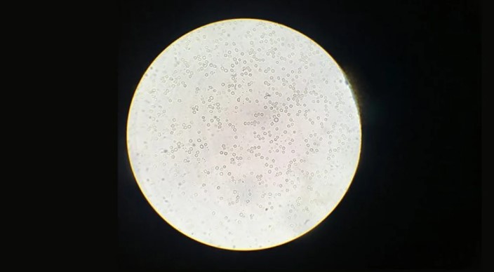 Científicos argentinos desarrollan una prometedora vacuna nasal contra el Chagas