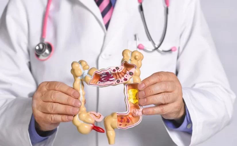 Una nueva droga demostró duplicar la sobrevida libre de progresión del cáncer de colon avanzado