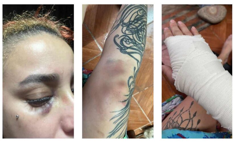 Denuncia por apremios ilegales en operativo policial en terminal de Santa Rosa